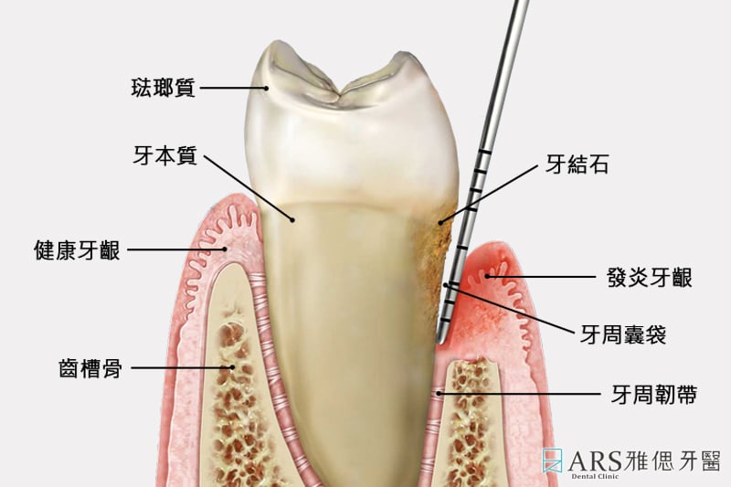 圖1- 牙齒結構