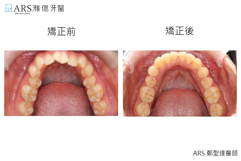 台北隱適美