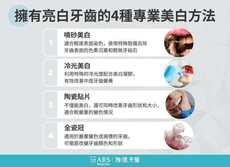 牙齒美白方法 擁有亮白牙齒的4種專業美白方法,介紹噴砂美白、冷光美白、陶瓷貼片及全瓷冠的適用情況與特色